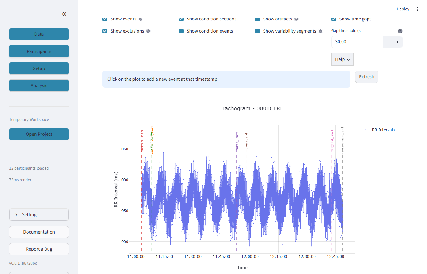Tachogram showing RR intervals with events and artifacts